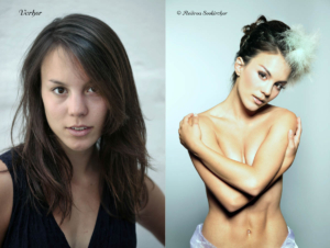 Vorher Nachher Fotos